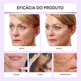 Sérum Facial com Arginina – Nutrição, Firmeza e Pele Radiante em Poucos Dias
